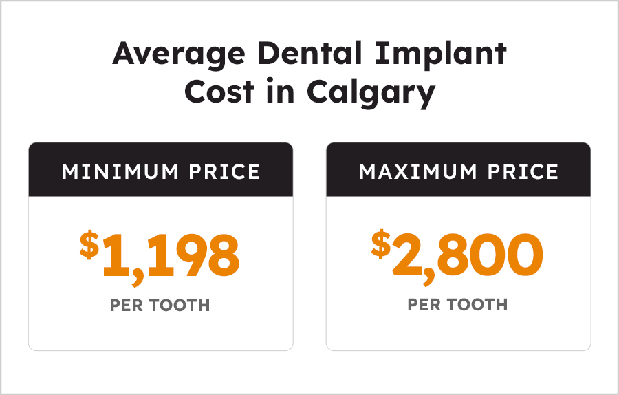 Average Cost of Dental Implant in Calgary